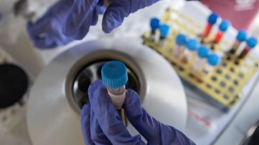 Elnuevo sistema digital de Senasa optimiza los diagnósticos en sanidad animal.