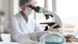 Desafíos globales frente a la resistencia antimicrobiana. Desafíos globales frente a la resistencia antimicrobiana.