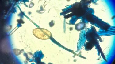 La fasciolosis afecta al 60 % de los ovinos en zonas endémicas.