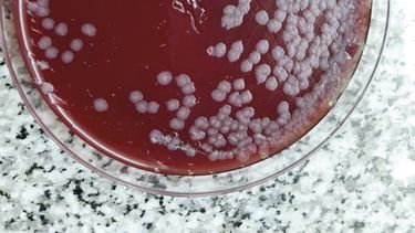 confirmado: la batalla la gano el carbunclo