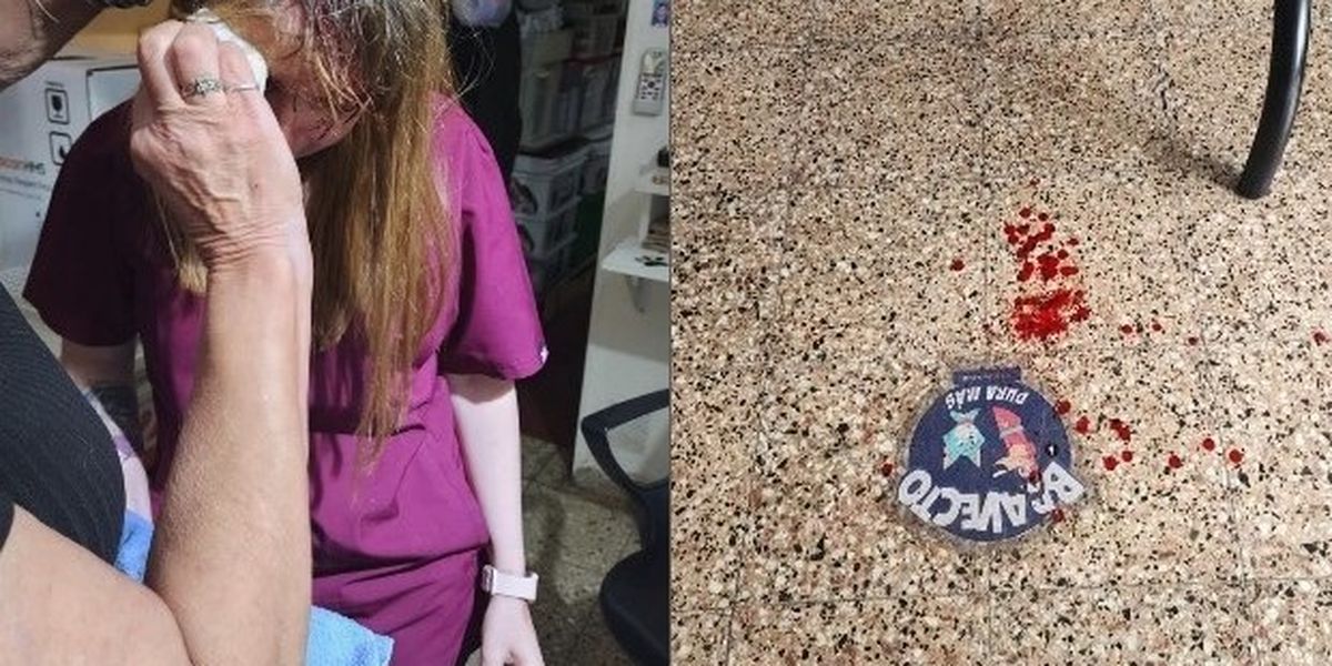 La MV Rosa Saturno recibió un salvaje golpe en la cabeza en la puerta de su veterinaria. La MV Rosa Saturno recibió un salvaje golpe en la cabeza en la puerta de su veterinaria.