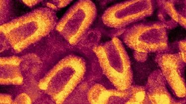 Rabia. Imagen por microscopía electrónica.