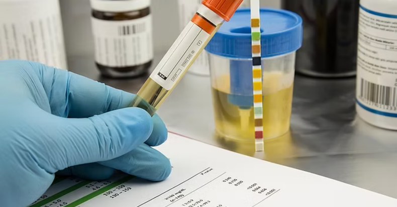 Veterinarios suman herramientas para mejorar el uroanálisis y diagnóstico.