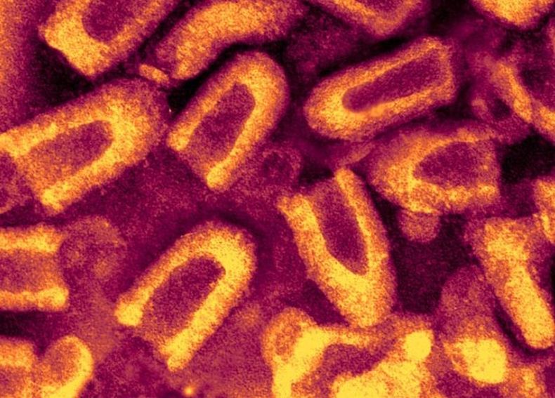 Rabia. Imagen por microscopía electrónica.