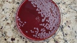 El Laboratorio Azul confirmó el diagnóstico de carbunclo en las muestras tomadas. El Laboratorio Azul confirmó el diagnóstico de carbunclo en las muestras tomadas.