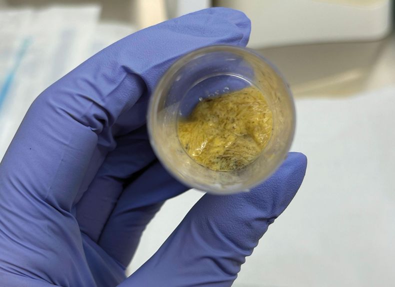 Para un diagnóstico preciso de la diarrea neonatal bovina, es fundamental remitir las muestras adecuadas al laboratorio.