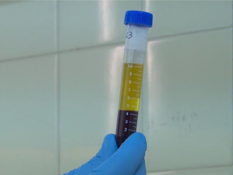 inta leucosis bovina.jpg