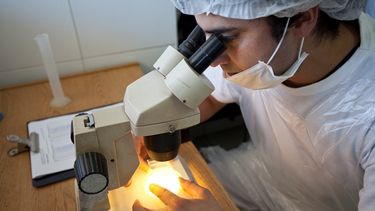 Diagnósico de triquinosis. Se recomienda enviar muestras individuales por cada animal capturado.