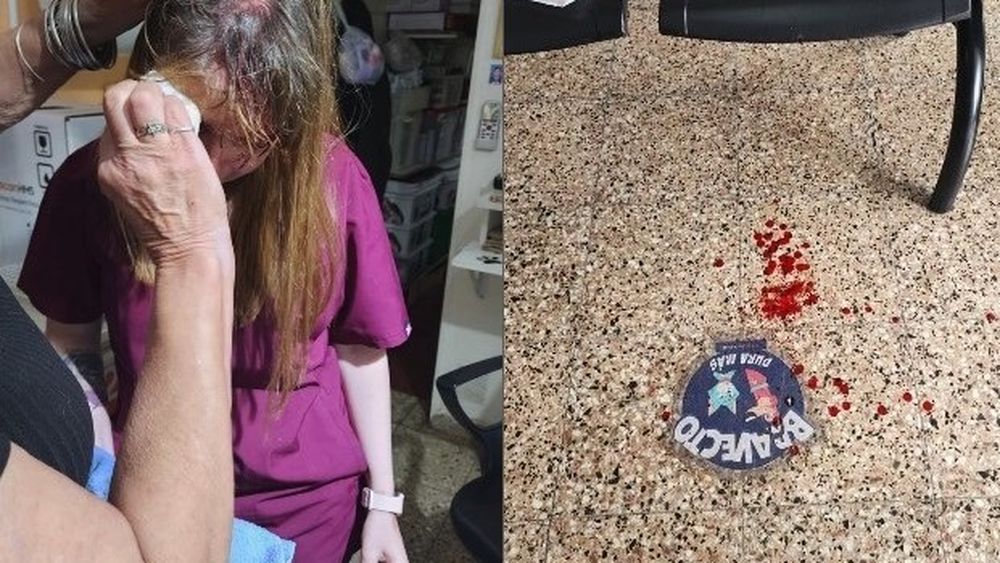 La médica veterinaria agredida recibió suturas y debió someterse a estudios de alta complejidad. La médica veterinaria agredida recibió suturas y debió someterse a estudios de alta complejidad.