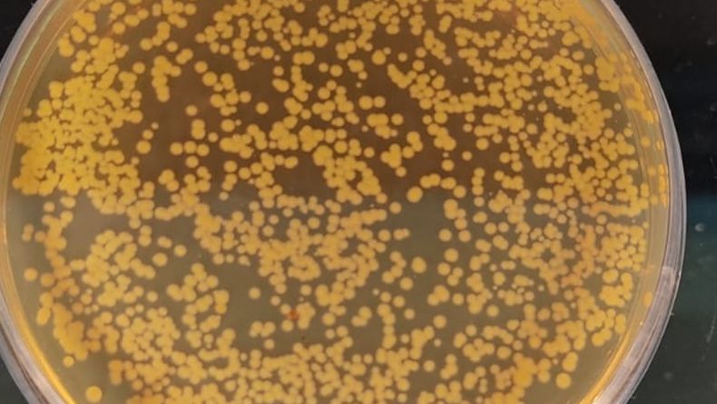 “La resistencia antimicrobianaes un problema que lejos de solucionarse nos plantea un desafío constante”