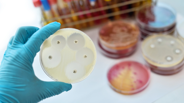 Uso adecuado de antimicrobianos, clave para la salud global.