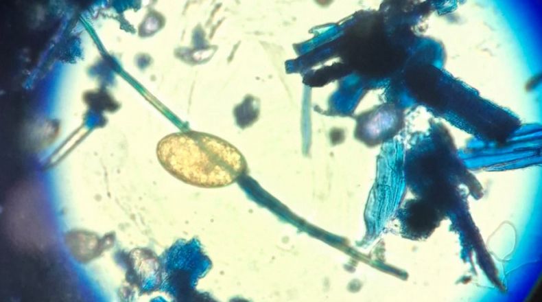 La fasciolosis afecta al 60 % de los ovinos en zonas endémicas.