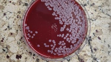 El Laboratorio Azul confirmó el diagnóstico de carbunclo en las muestras tomadas.