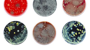 La resistencia antimicrobiana ya se vincula con más de 4,7 millones de muertes anuales a nivel global.