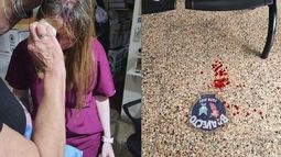 La MV Rosa Saturno recibió un salvaje golpe en la cabeza en la puerta de su veterinaria. La MV Rosa Saturno recibió un salvaje golpe en la cabeza en la puerta de su veterinaria.