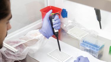 Técnicas para detecar la Tricomoniasis bovina.&nbsp;