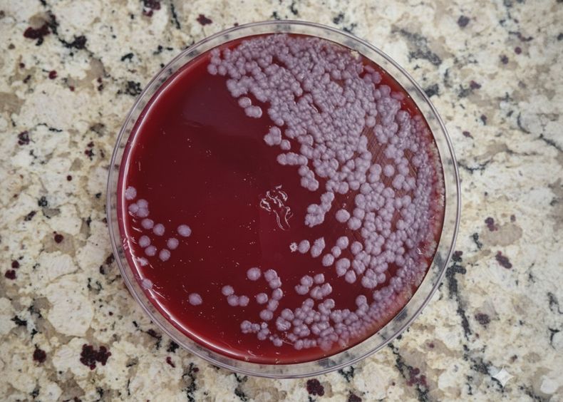 El Laboratorio Azul confirmó el diagnóstico de carbunclo en las muestras tomadas.